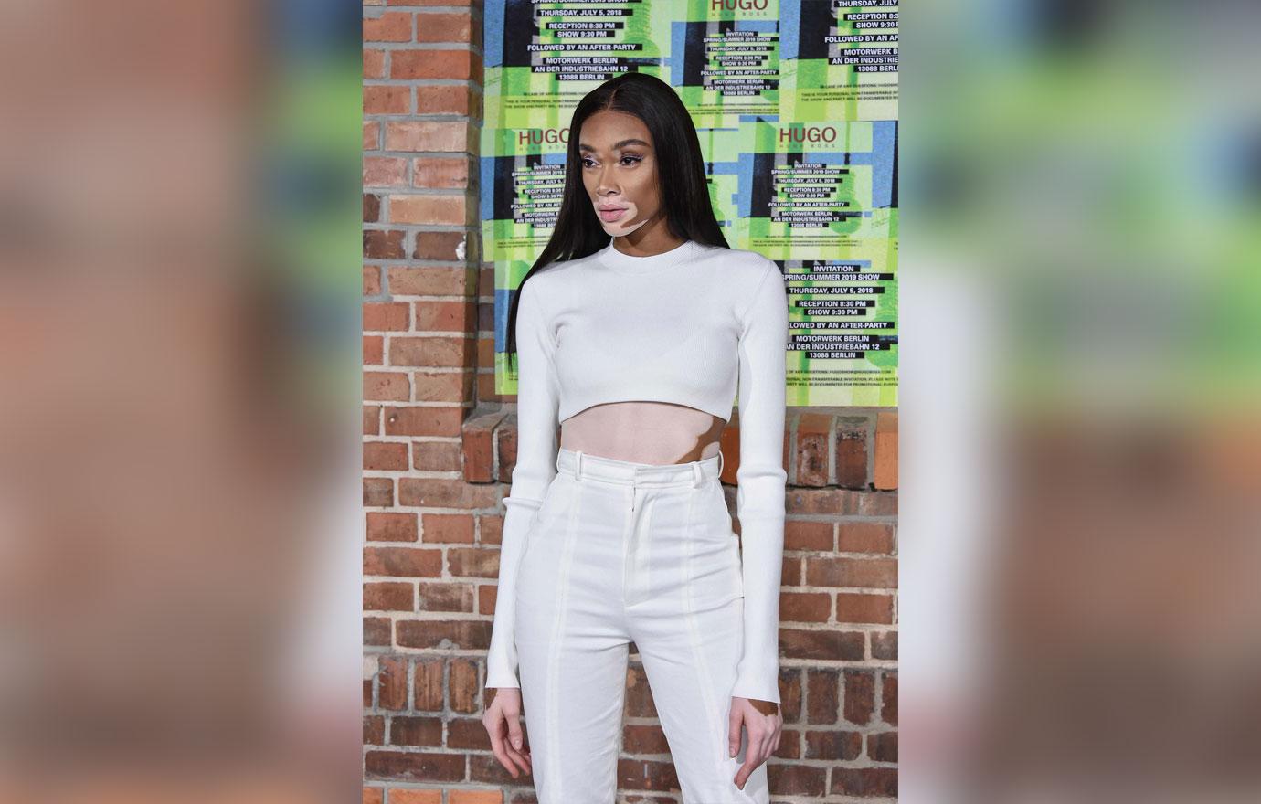 Winnie Harlow Says America's Next Top Model “Didn't Do Anything” for Her  Career