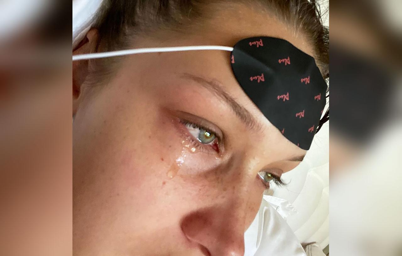 Bella Hadid Shares Crying Selfies In Mental Illness Post