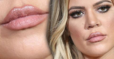 Khloe Kardashian plumped lips