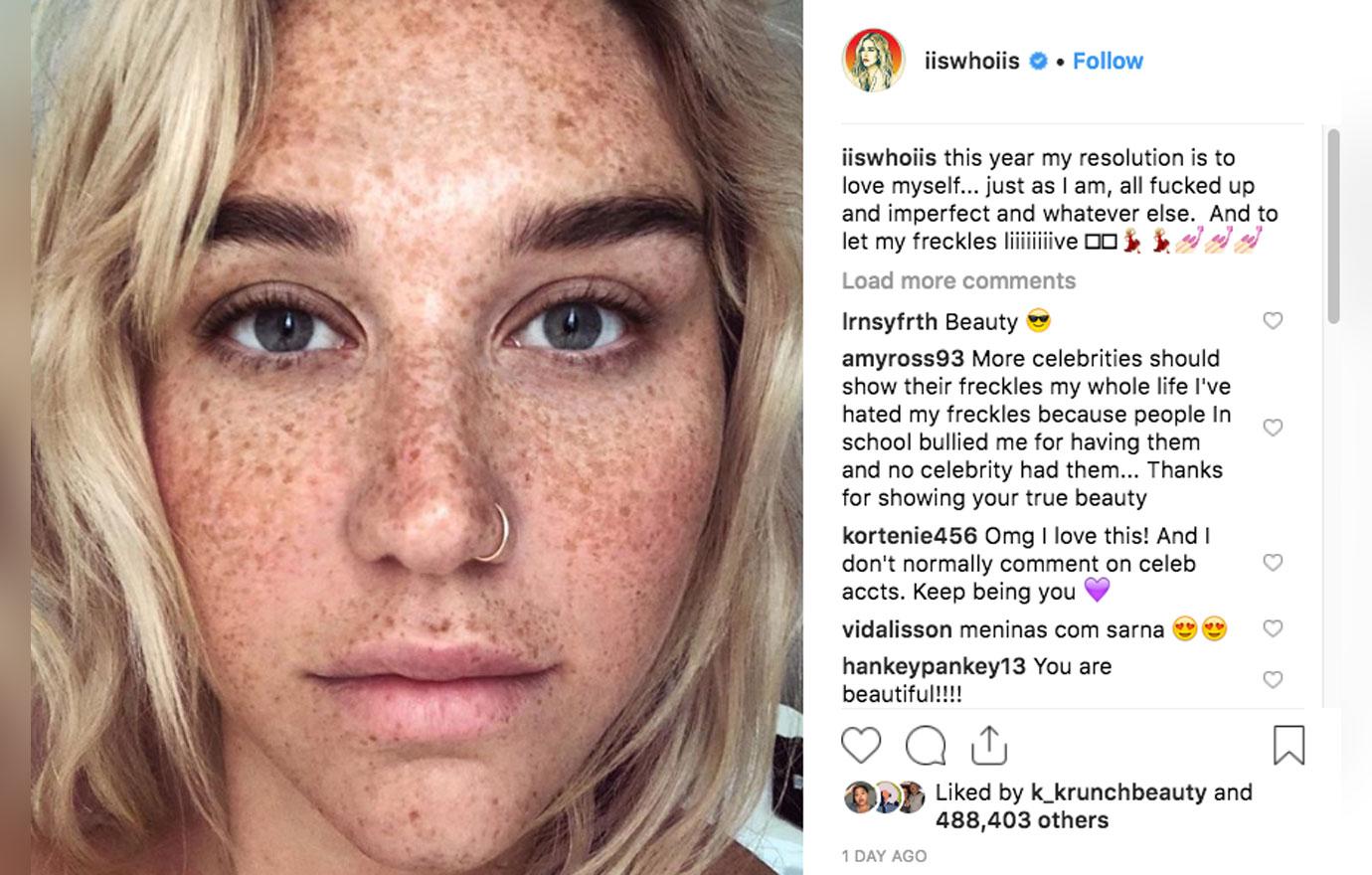 Kesha Shows Off Freckles In Gorgeous Makeup-Free Selfie