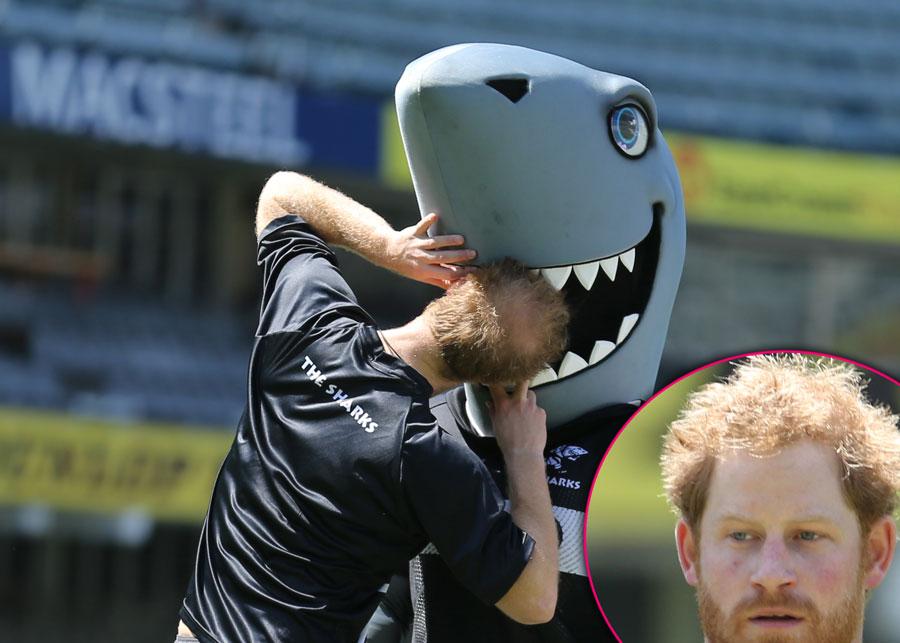 Prince harry going bald hair loss charles william 03