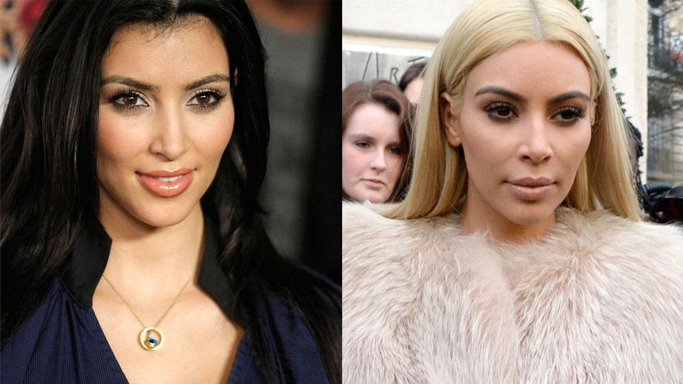 Kim Kardashian: Plastic Surgery (2000-2020)