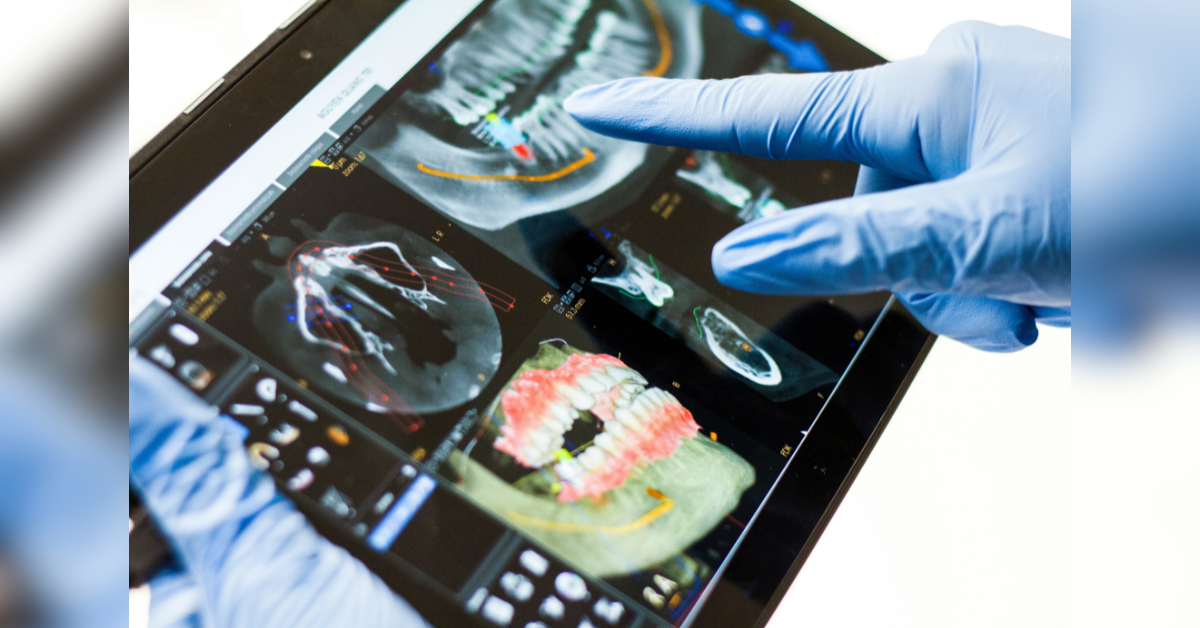 the future of dental care how ai d printing and teledentistry are transforming smiles