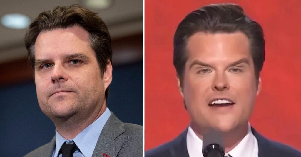 Matt Gaetz's Physical Appearance Sparks Concern After RNC Speech