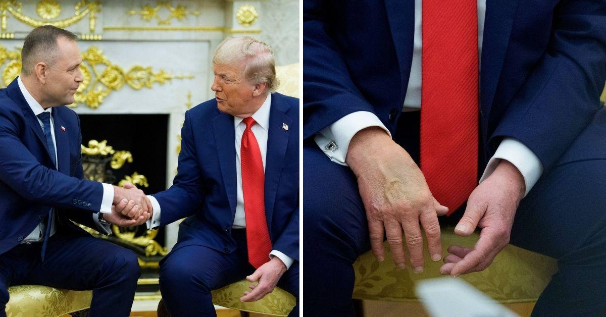 image of White House officials insist the president is in 'excellent overall health.'