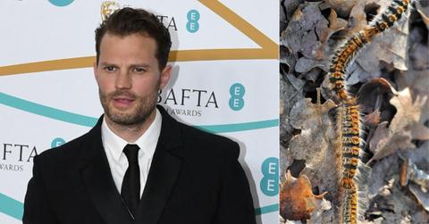 jamie dornan hospitalized heart attack symptoms poisonous caterpillars