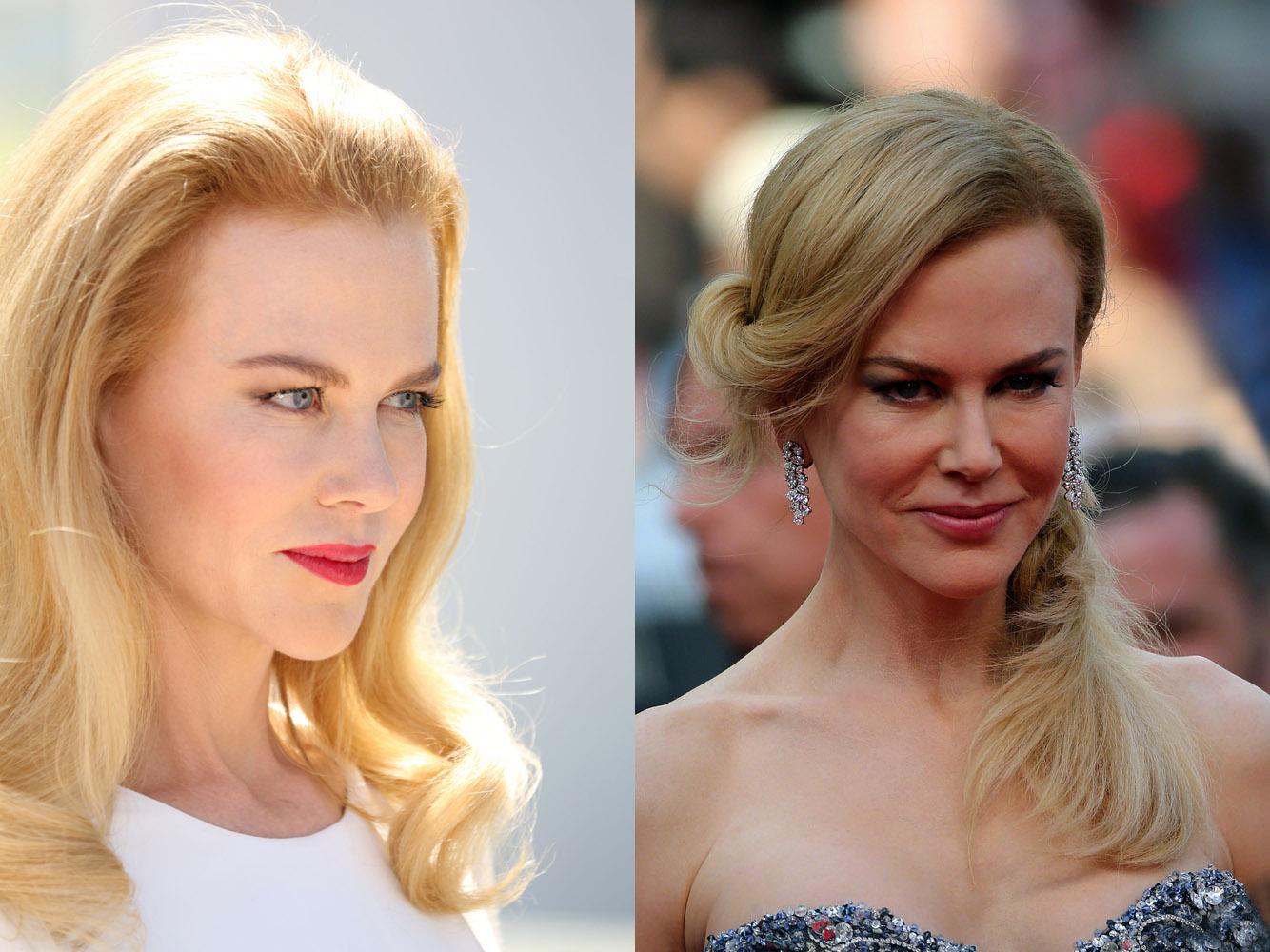 2 nicole kidman botched lips SPL