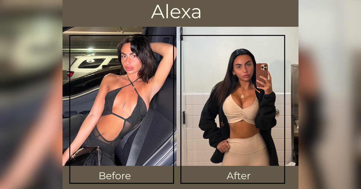 the case for the cosmetic twins alexa corey arnowitz embrace empowerment through surgery