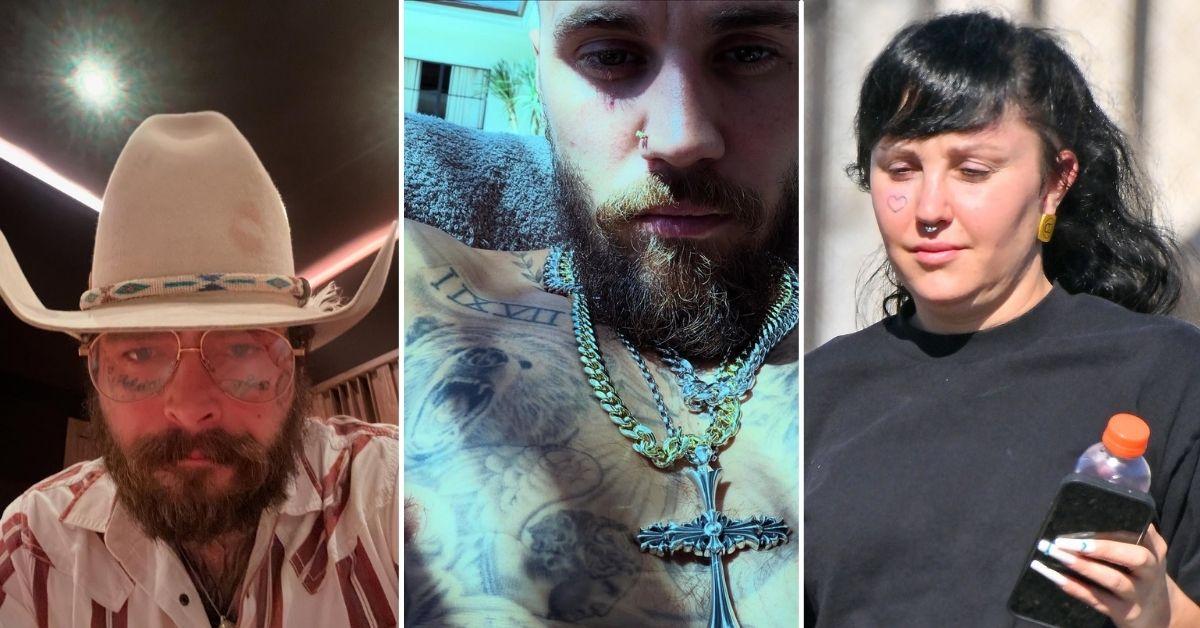 image of Justin Bieber. Post Malone and Amanda Bynes embraced face tattoos.