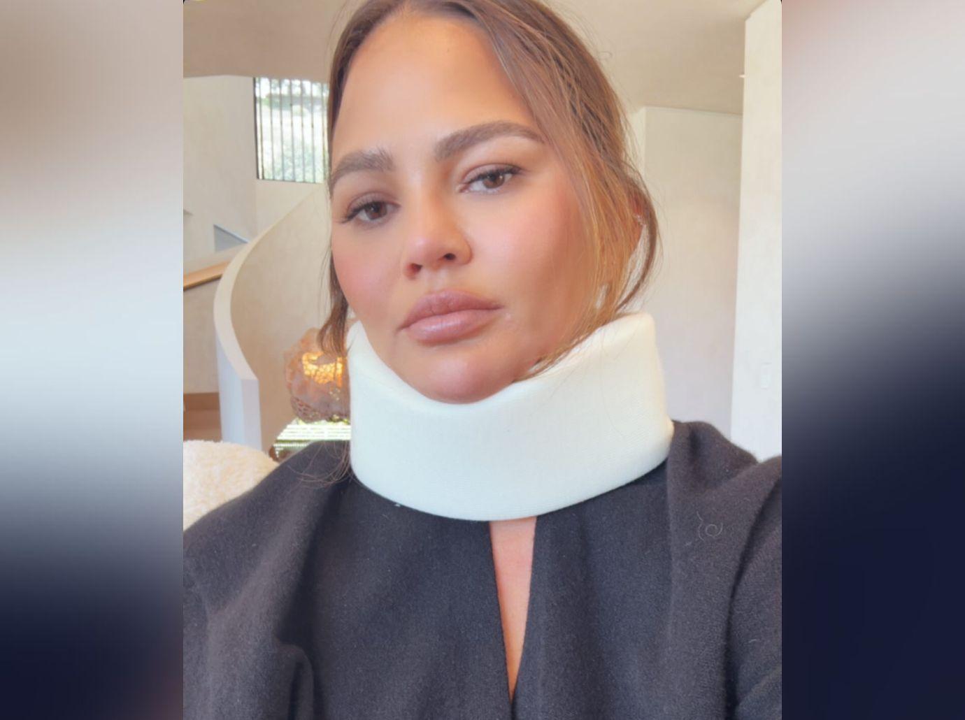 chrissy teigen neck injury isnt why john legend skipped met gala