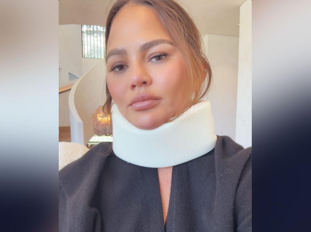 Chrissy Teigen's Neck Injury Isn't Why She Skipped 2024 Met Gala
