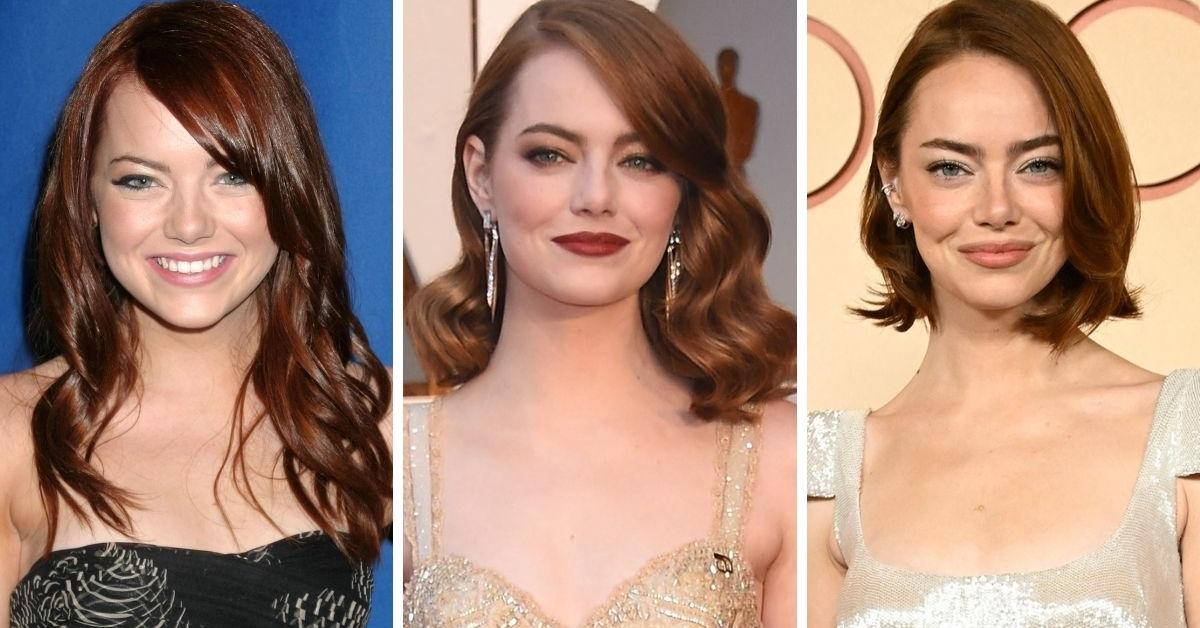 Emma Stone's Transformation in Before and After Photos Amid&hellip;