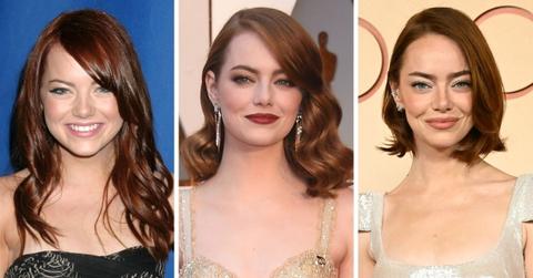 emma stone transformation before after photos