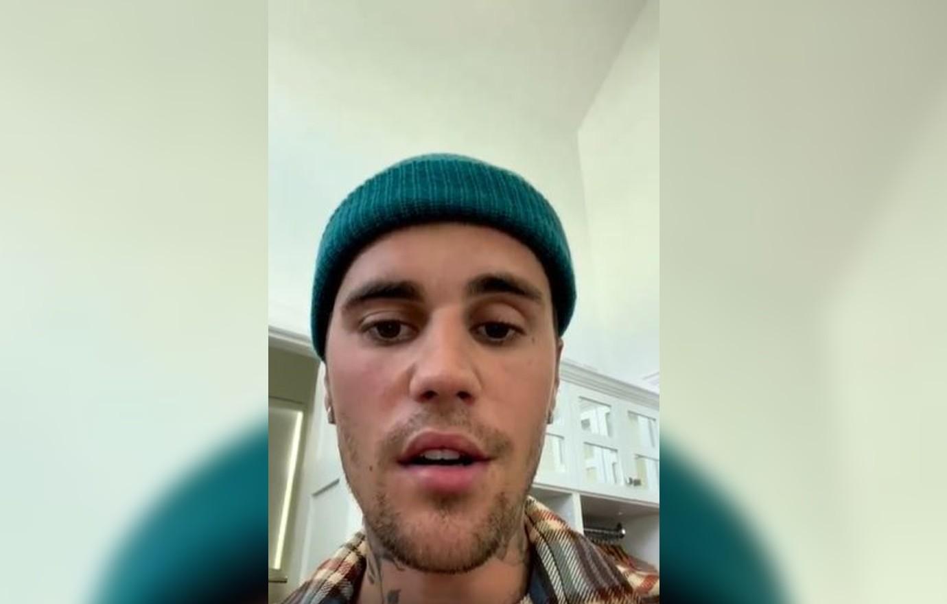 justin bieber suffers shocking facial ticks mystery illness