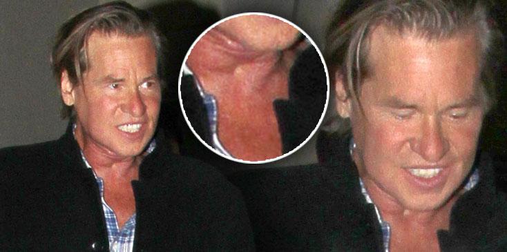 Val kilmer throat tumor recovery photos 0