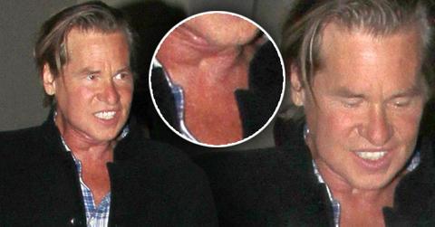 Val Kilmer Makes Huge Step On The Road To Recovery From Throat Tumor