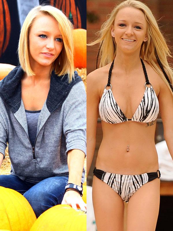 Teen mom plastic surgery