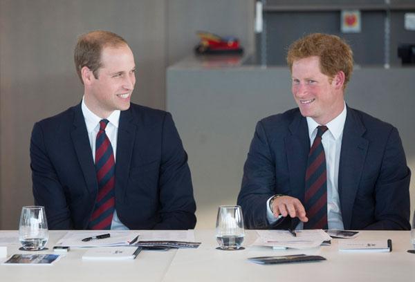 Prince harry hair plugs hair loss issues updates 05