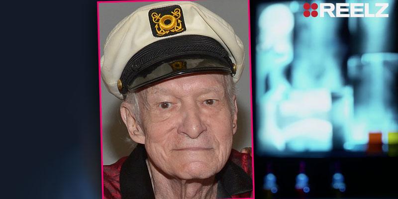 Hugh Hefner Acute Back Pain Death