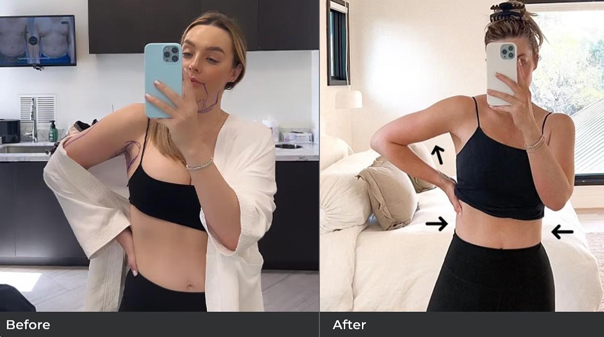 lauryn bosstick airsculpt