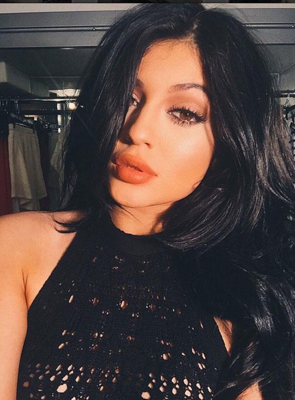 Kylie Jenner Plastic Surgery