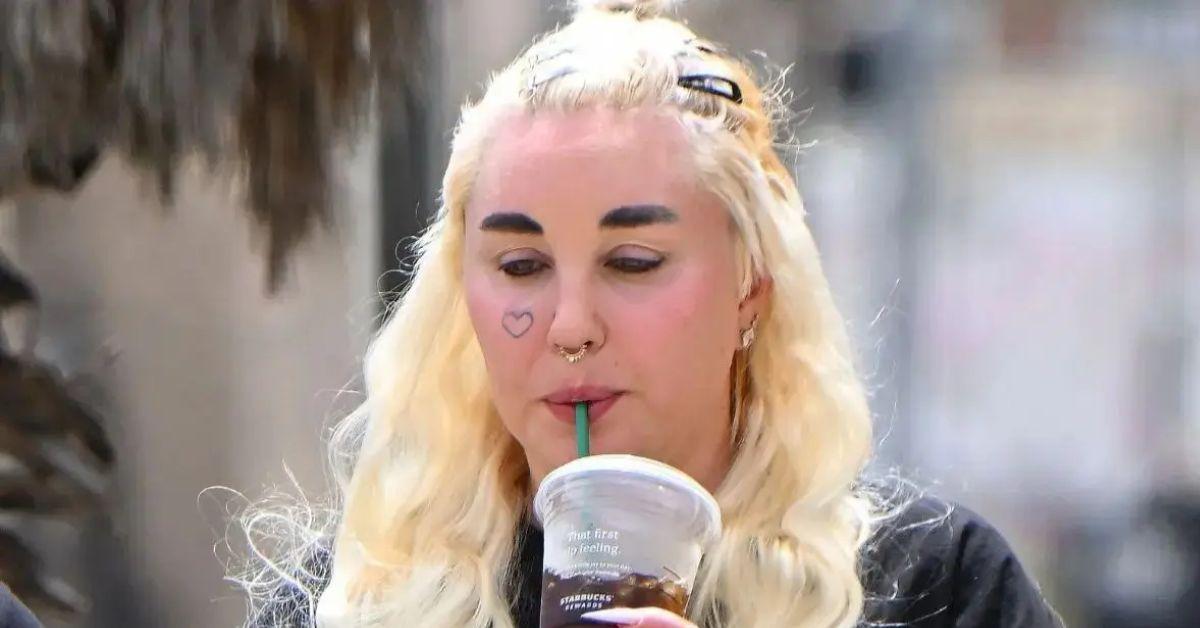 image of Amanda Bynes has also had work done to her face.