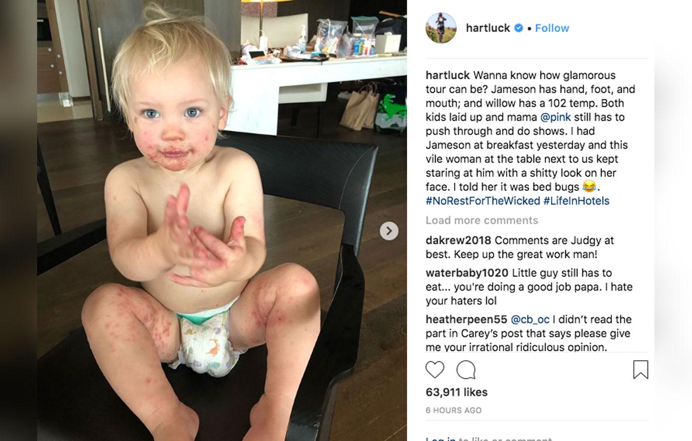 Pink’s 1 year old son hand foot mouth disease 4