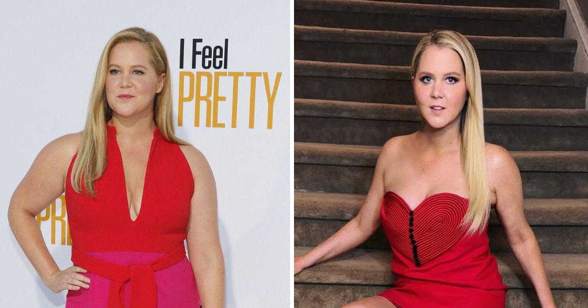 amy schumer explains why she deleted pre weight loss photos