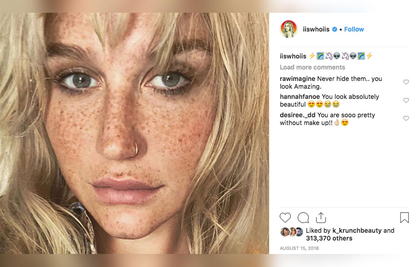 Kesha Shows Off Her Freckles In MakeupFree Selfie