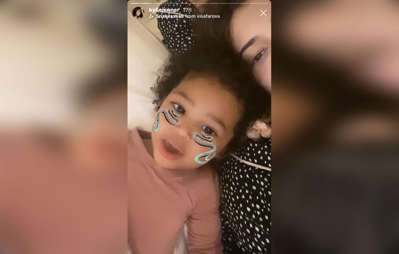 Kylie Jenner’s Daughter Stormi Takes Care Of Her After Procedure