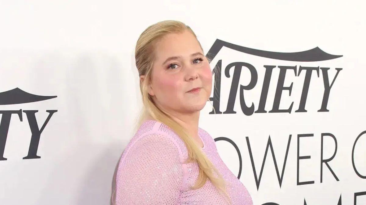 Photo of Amy Schumer lost weight after she was diagnosed with Cushing syndrome.