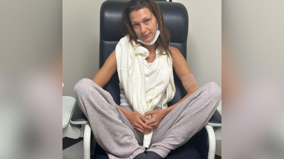 Image of Bella Hadid was diagnosed with Lyme disease in 2012.