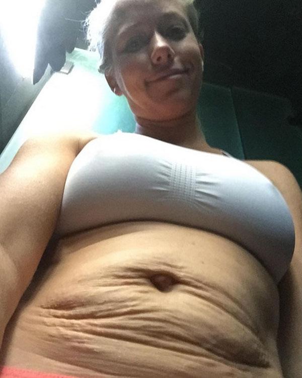 kendra wilkinson stretch marks