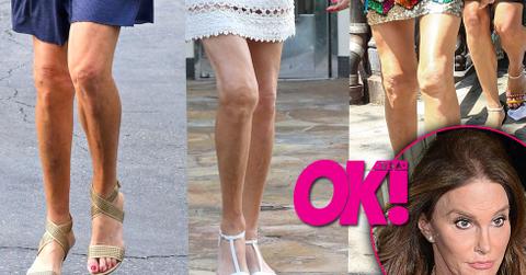 Caitlyn jenner surgery knees lipo laser 01