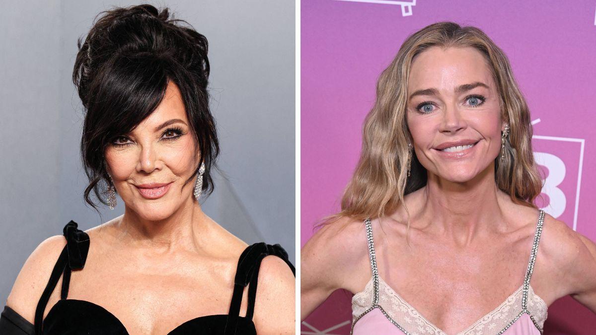 celebrities who got facelifts before after photos