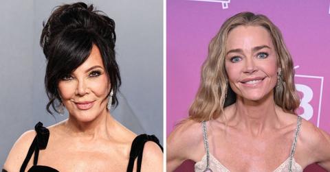 celebrities who got facelifts before after photos