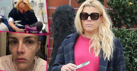 Busy phillips eye injusry hospital pp