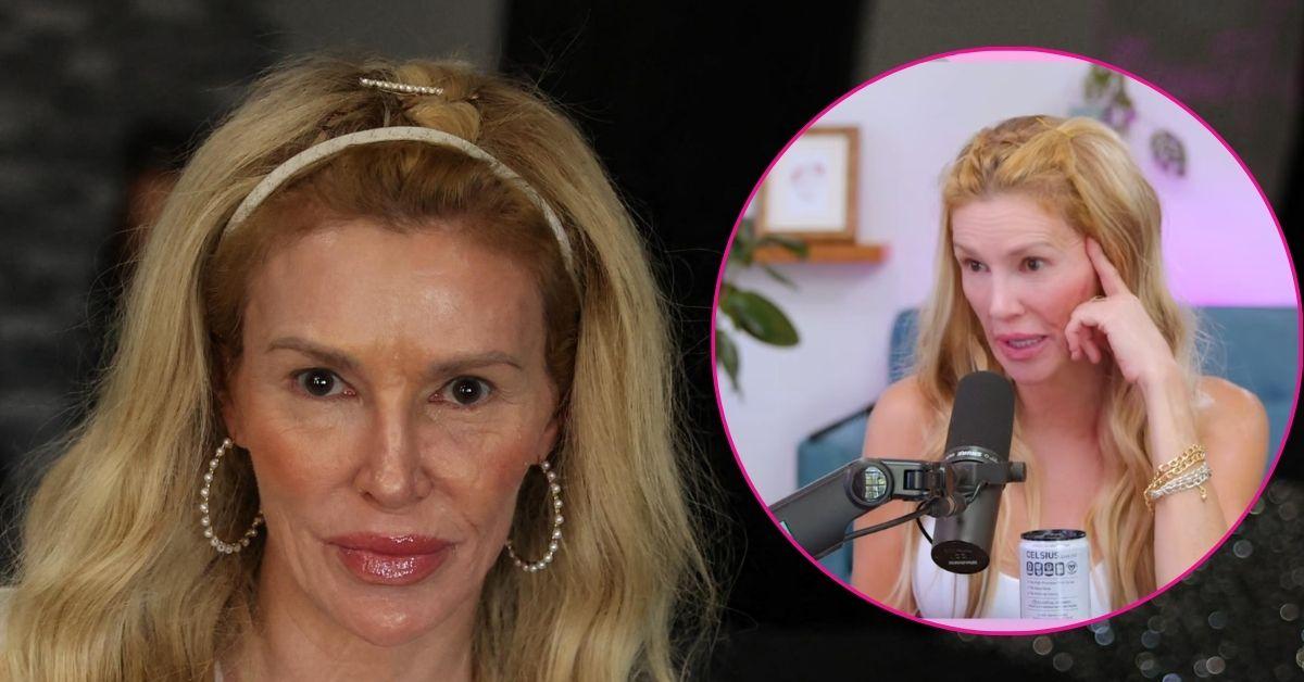 brandi glanville health struggles ringworm photo