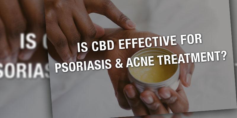 CBD acne