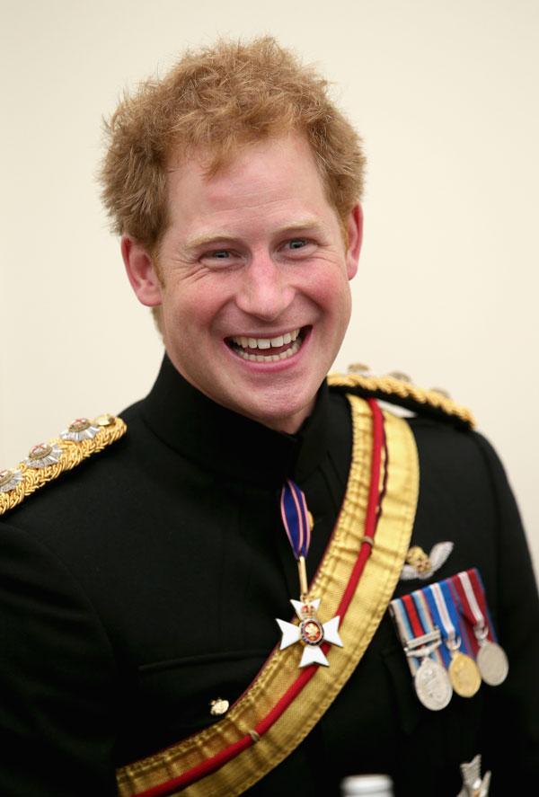 Prince harry hair plugs hair loss issues updates 01