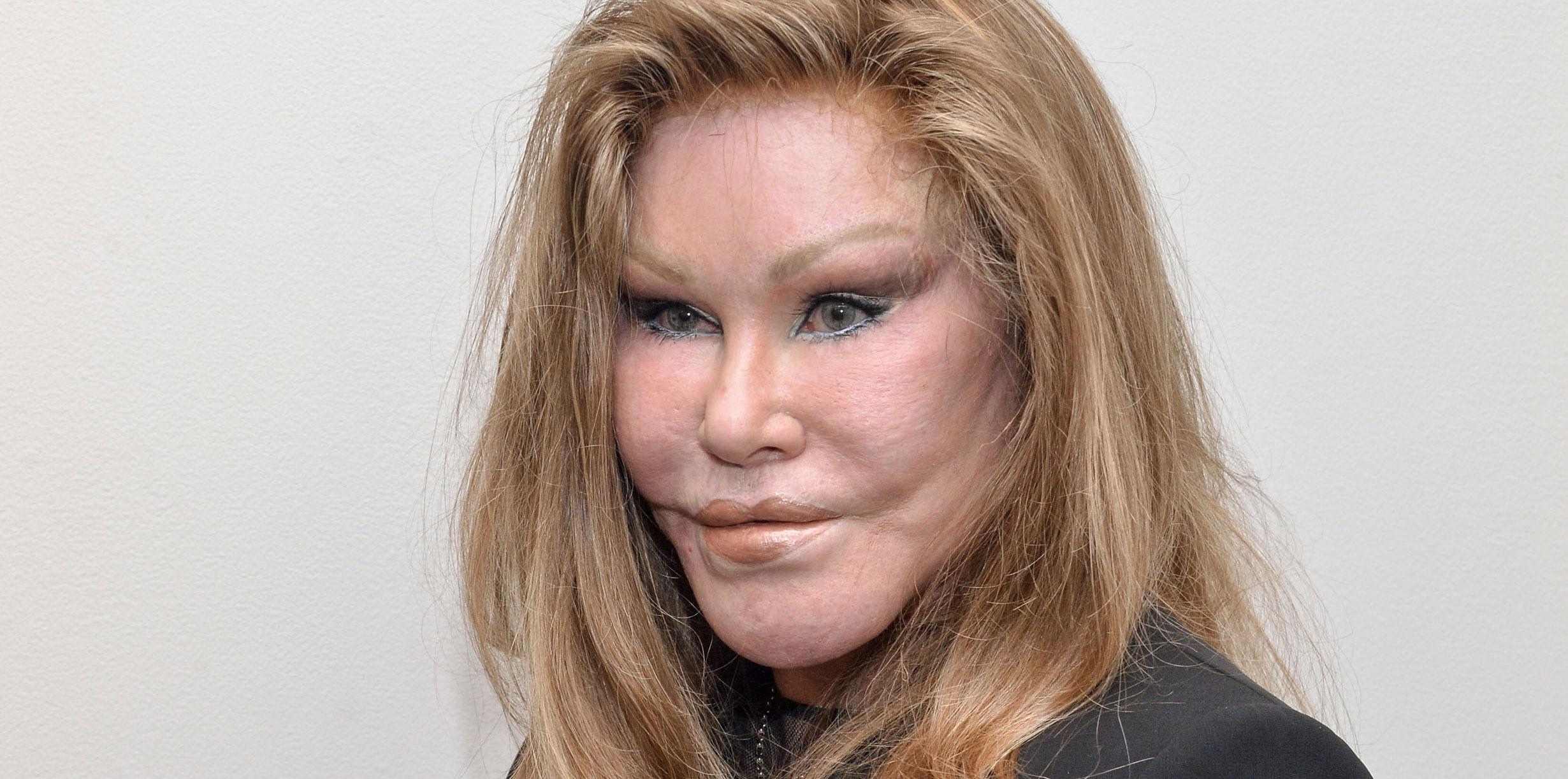 Catwoman jocelyn wildenstein arrested felony assualt 05