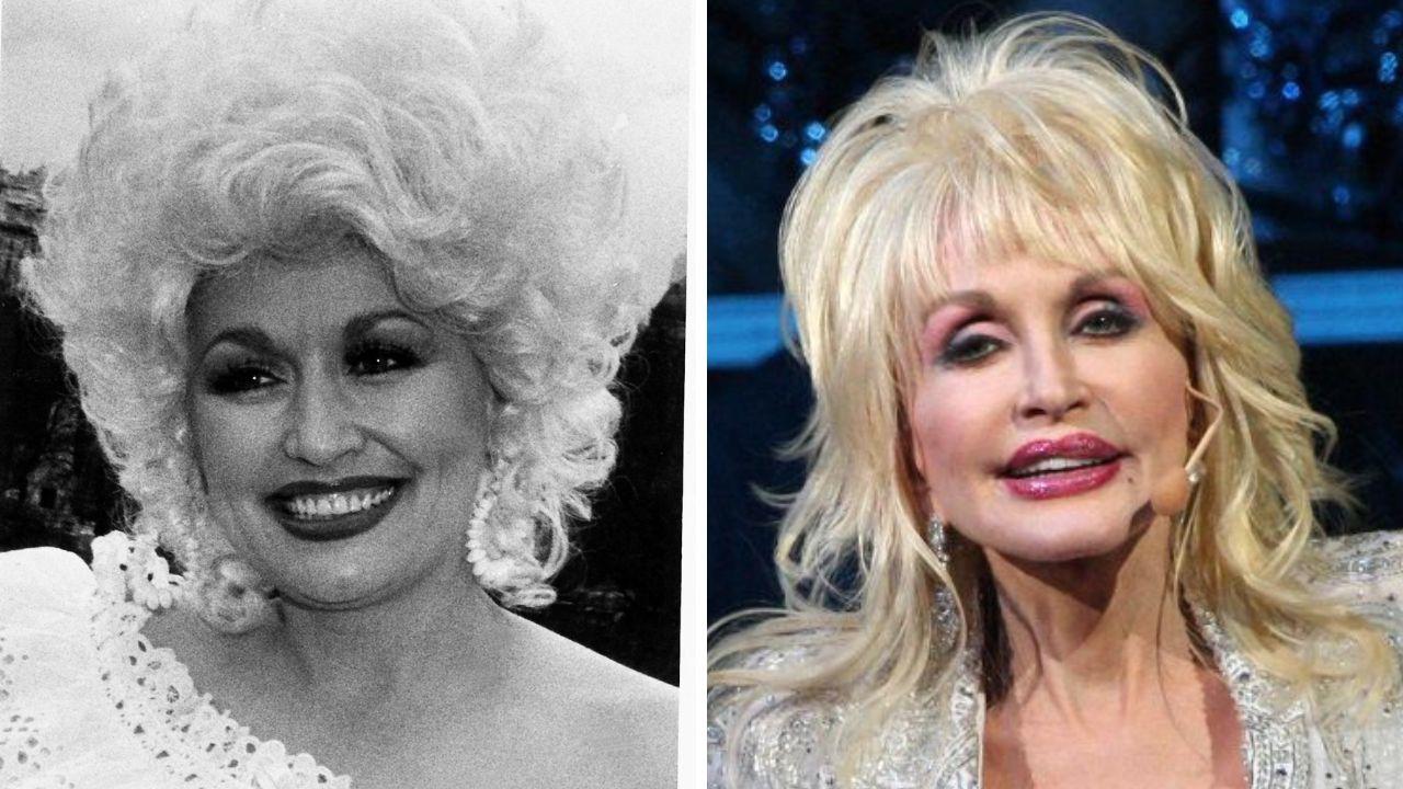 dolly parton plastic surgery every cosmetic procedure she admitted to having