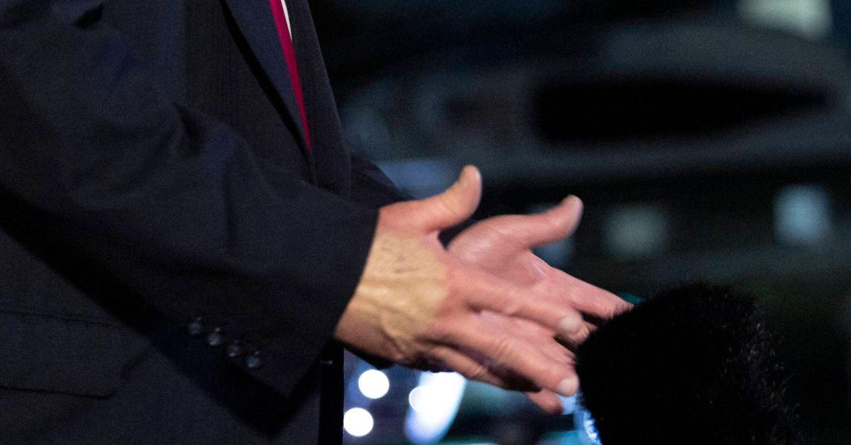 image of It was revealed in July the president was diagnosed with chronic venous insufficiency.