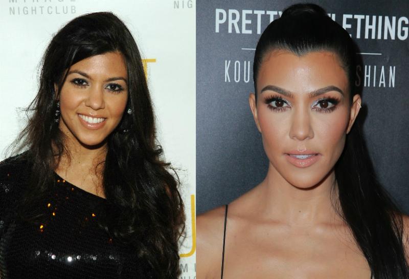 Kourtney kardashian celebrity plastic surgery