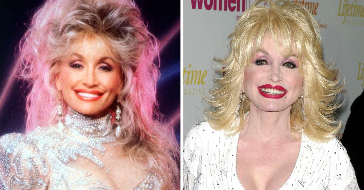 Dolly Parton's Plastic Surgery Journey: Every Cosmetic Procedure She Admitted to Having