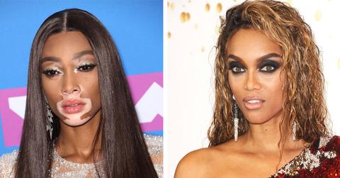 Winnie Harlow Tyra Banks