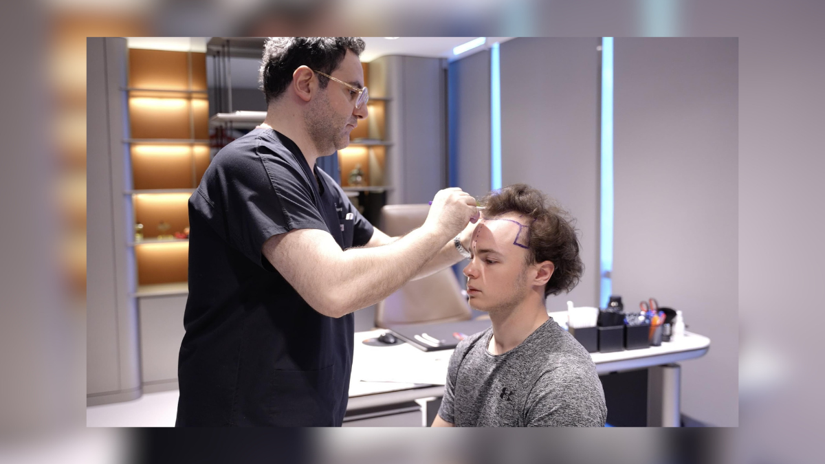 hair transplant in turkey a closer look at cost care and results