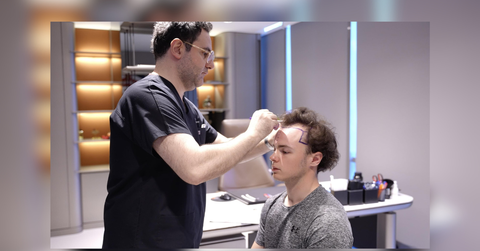 hair transplant in turkey a closer look at cost care and results