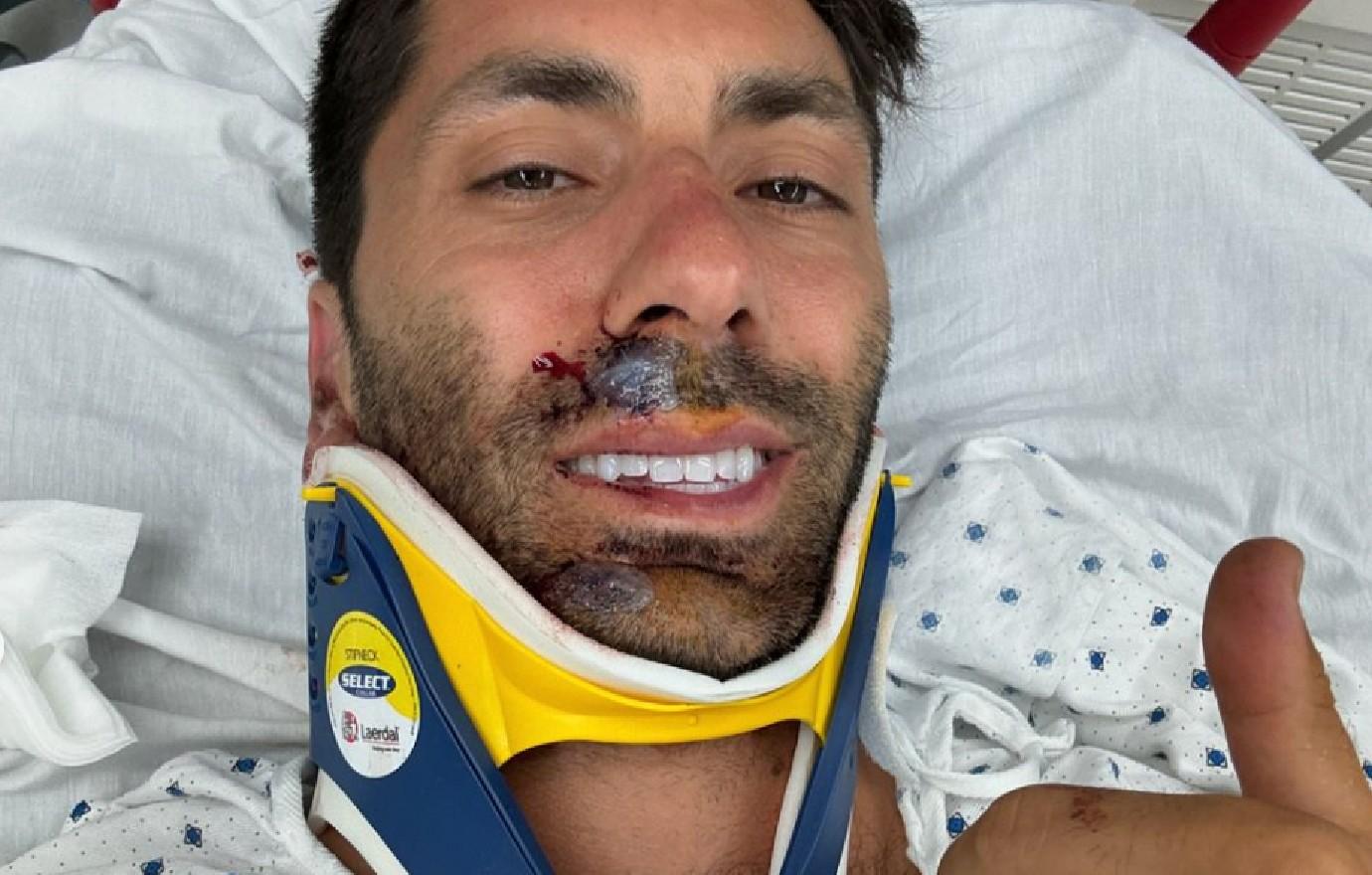 nev schulman reveals broke neck near fatal biking accident photos