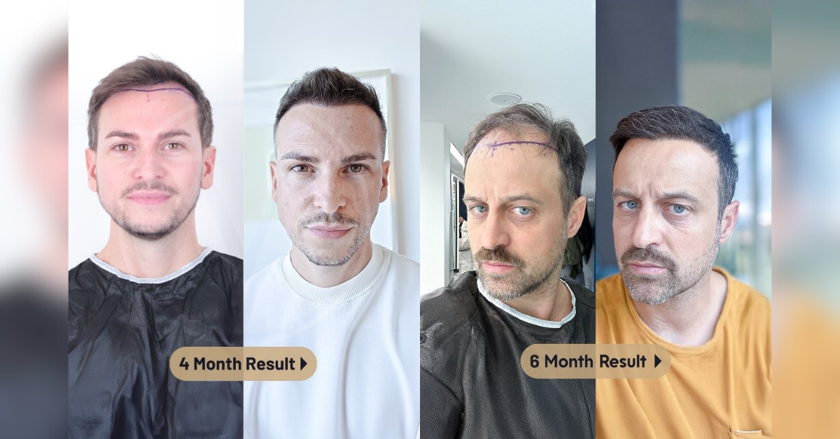 istanbul vita vita technique microscopic planning